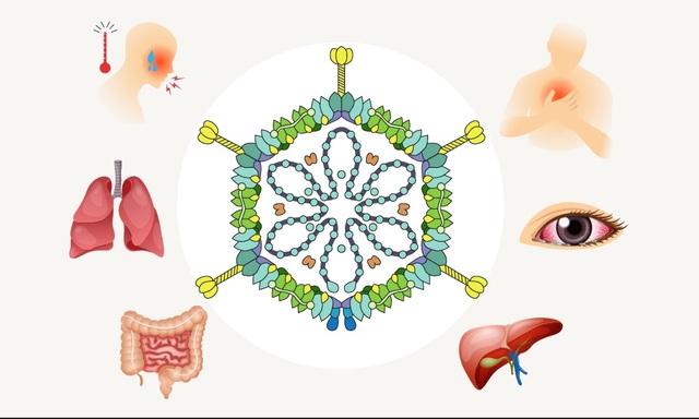 Adenovirus gây bệnh ở trẻ em, những điều phụ huynh cần lưu ý